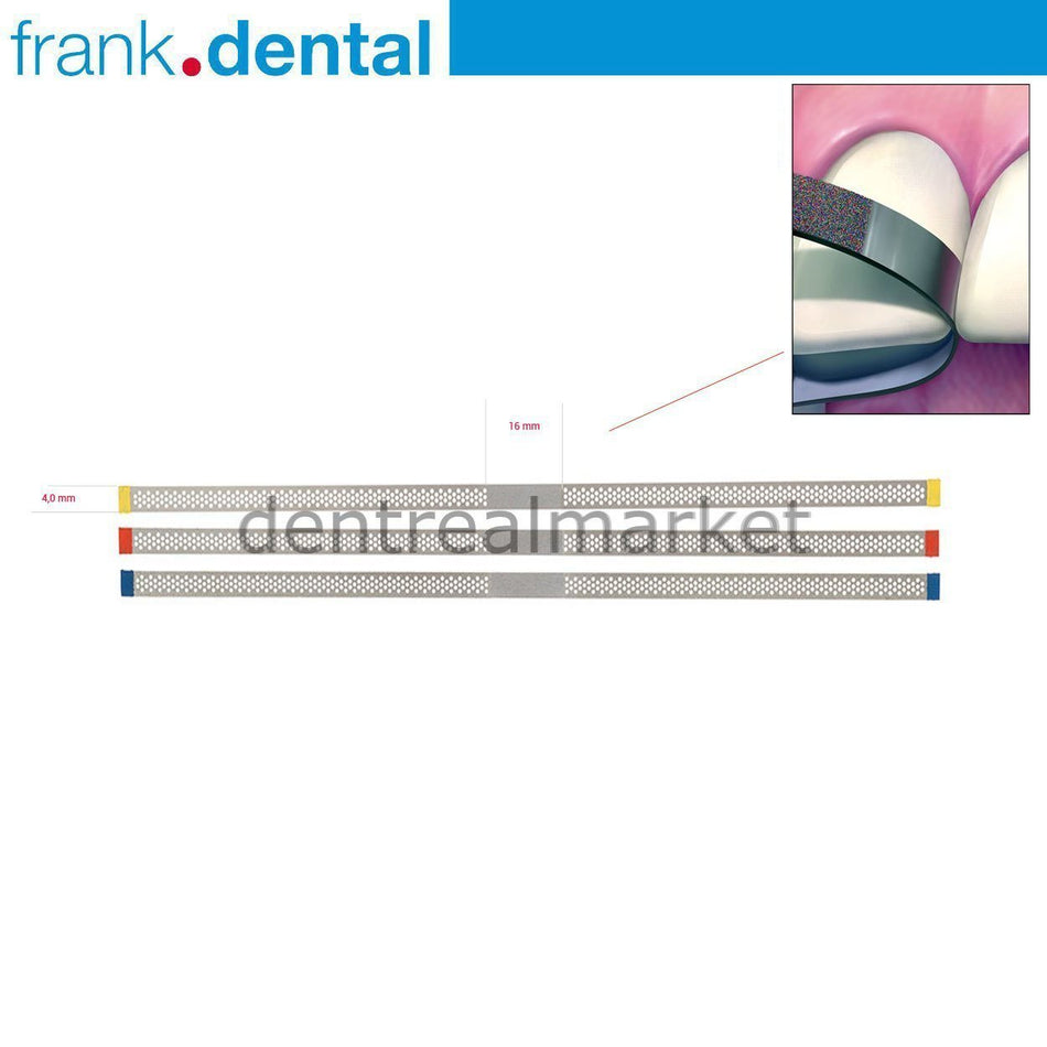 Frank Dental - Interface Sander with Interproximal Holes 4.0 mm