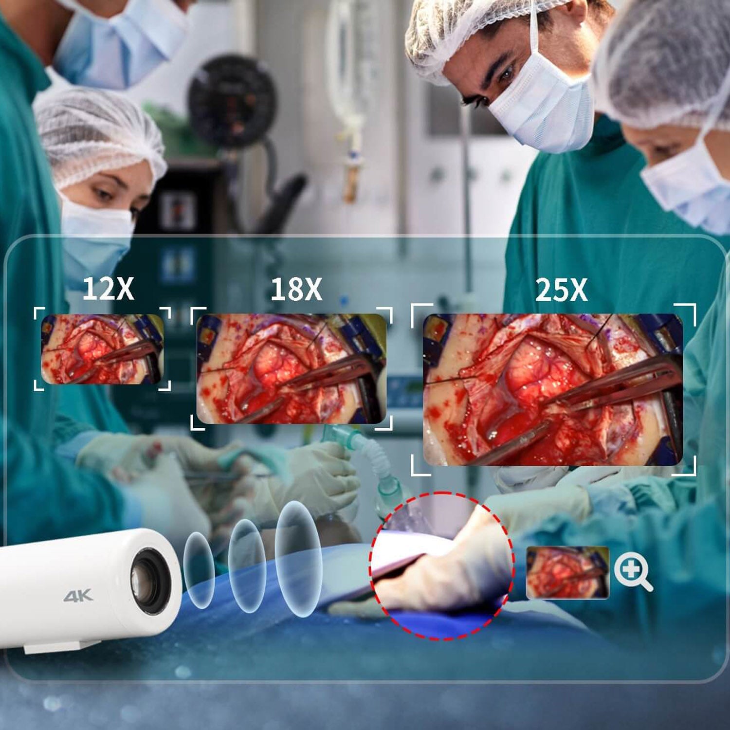 Zowietec - Medicam 4K NDI Surgical Video Camera Optic 18X Zoom