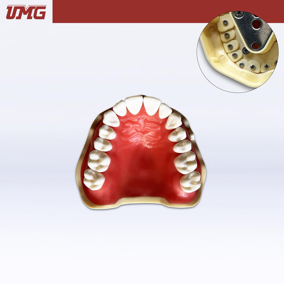 Umg Dental - Umg Model Removable Teeth Training Model Upper - Frasaco Compatible - UM - A2F