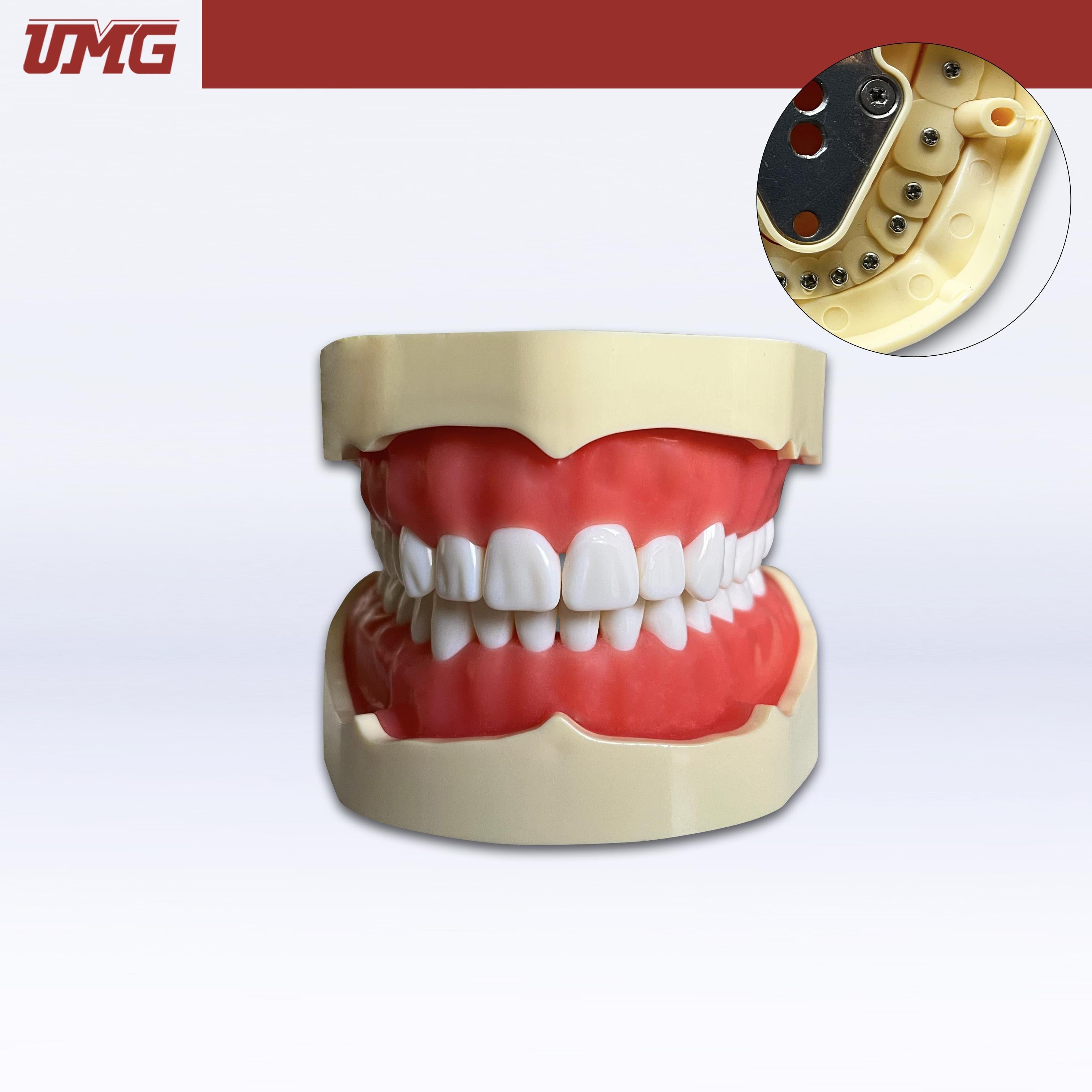 Umg Dental - Umg Model Removable Teeth Training Model Upper Lower Jaw Set - Frasaco Compatible - UM - A2F