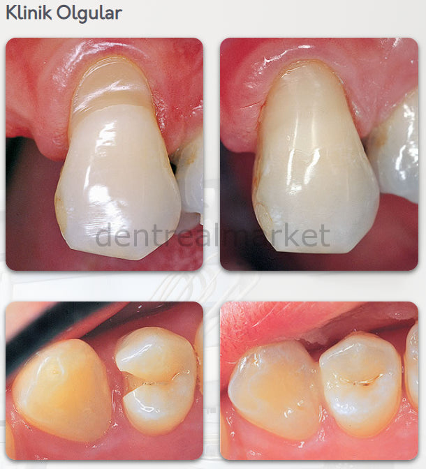 DentrealStore - Pentron Flow-It ALC Flowable Composite - 6x1,5 gr - A3