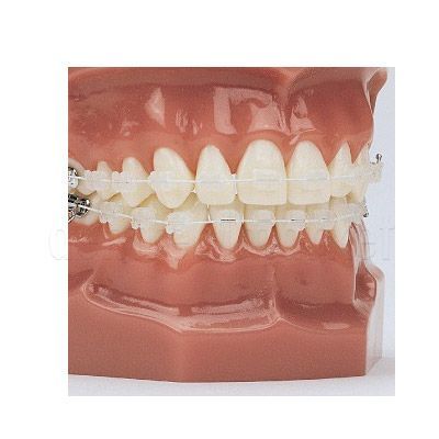 DentrealStore - Dynaflex Birilliant Niti Coated Cosmetic Wire