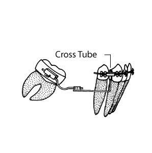 Cross Tubes Tube - 10 pcs