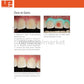 Ultradent - Opalescence Boost PF 40% - Tooth Whitening - 1 Patient Kits