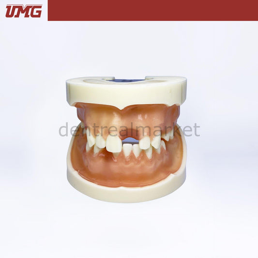 Umg Model Implant Training Model Upper-Lower Jaw - UM-2002