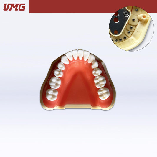Umg Model Removable Teeth Training Model Lower - Frasaco Compatible - UM-A2F